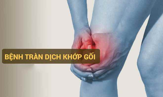 Nguyên nhân, triệu chứng và cách điều trị bệnh tràn dịch khớp gối