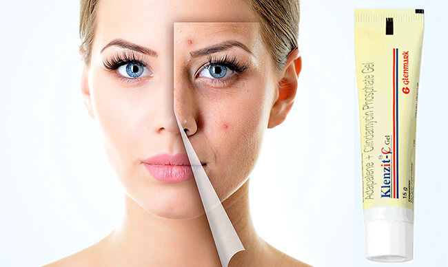 Những lưu ý đặc biệt khi dùng Klenzit C