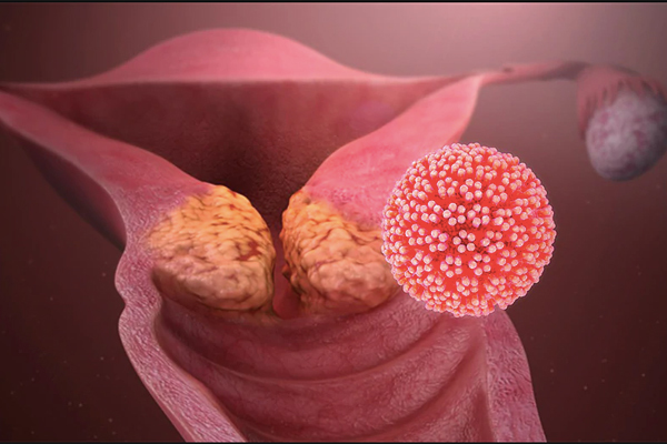 Phát hiện ung thư di truyền từ mẹ sang con