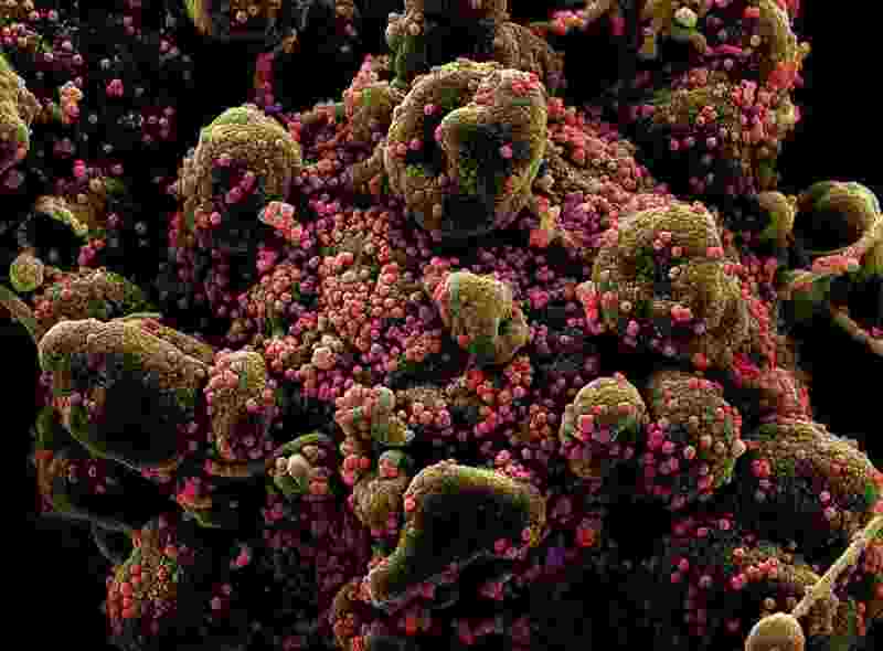 SARS-CoV-2 đã đột biến hơn 6.600 lần