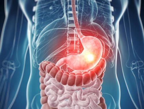 6 dấu hiệu cho thấy bạn có vấn đề về đường ruột