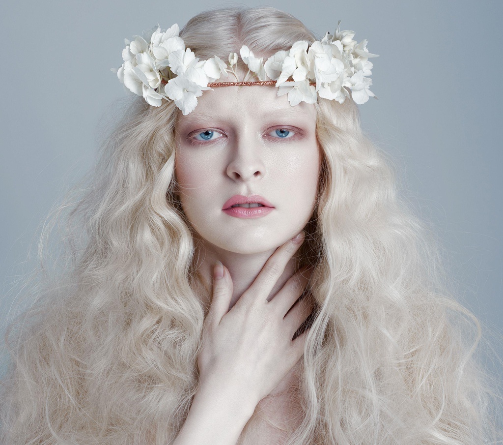 Bệnh bạch tạng là bệnh gì? Triệu chứng và cách điều trị bệnh hiệu quả