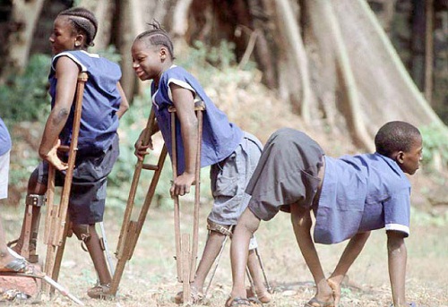 Bệnh bại liệt lây lan qua con đường nào?