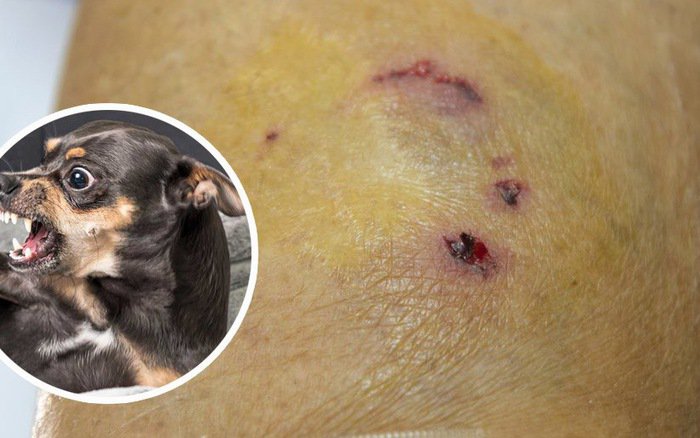 Bệnh chó dại cắn có chữa được không? Thời gian ủ bệnh là bao lâu?