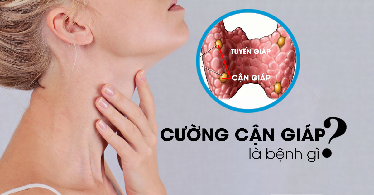 Bệnh cường cận giáp: Nguyên nhân, triệu chứng, cách điều trị và phòng ngừa