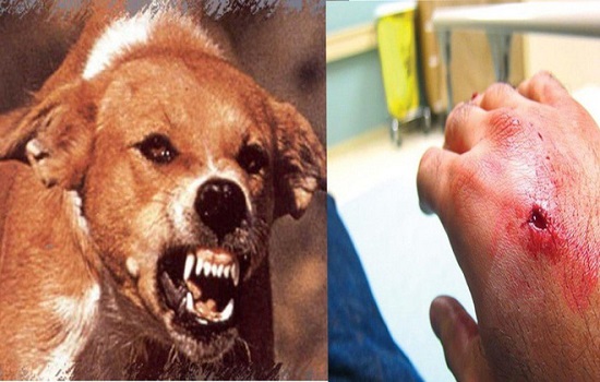 Bệnh dại ở người lây lan qua con đường nào?