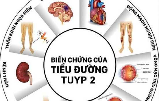 Bệnh đái tháo đường (tiểu đường) có chữa được không?
