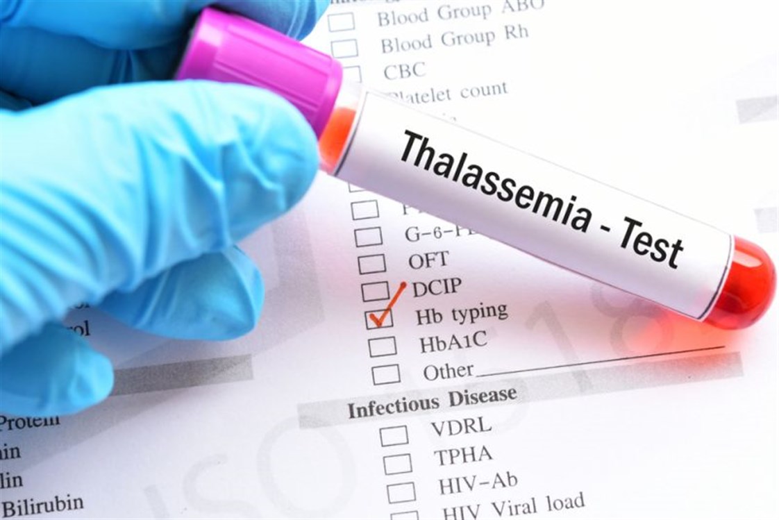 Bệnh Thalassemia là gì? Dùng phương pháp nào để chẩn đoán và điều trị bệnh?
