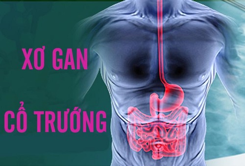 Bệnh xơ gan cổ trướng có lây không? Dấu hiệu nhận biết bệnh như thế nào?