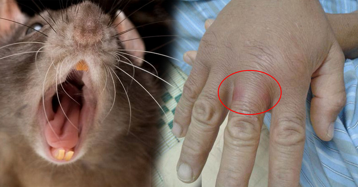 Bị chuột cắn có sao không? Hướng dẫn xử lý đúng cách khi bị chuột cắn