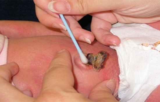 Biến chứng nguy hiểm của bệnh uốn ván