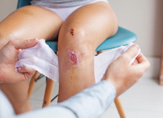 Các cách chăm sóc vết thương khi bị nhiễm trùng