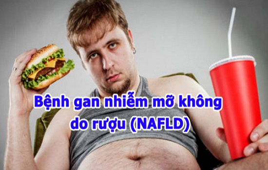 Các cách điều trị bệnh gan nhiễm mỡ không do rượu (nonalcoholic) hiệu quả