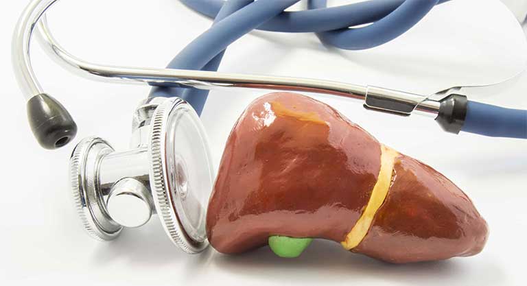 Cách nhận biết các bệnh về gan dễ gây nhầm lẫn với các chứng bệnh khác