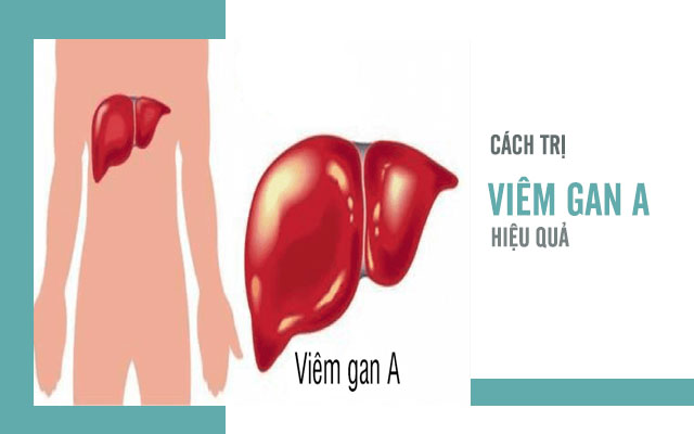 Cảnh báo mang bệnh Viêm gan A khi đi du lịch