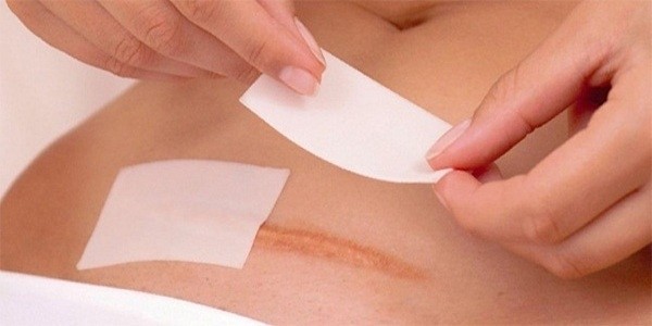 Dấu hiệu nhiễm trùng vết mổ sau sinh như thế nào? Cách chăm sóc vết mổ sau sinh