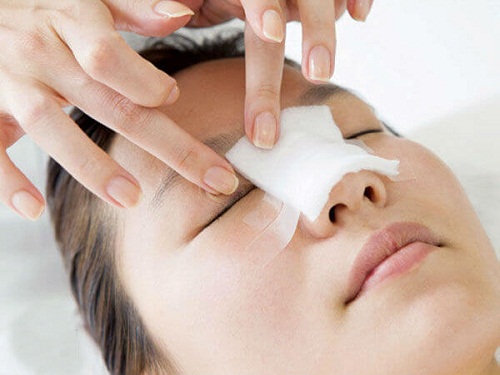 Giải mã thắc mắc nâng mũi bao lâu thì lành vết thương?