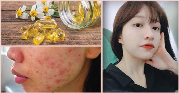 Mách bạn cách dùng Vitamin E bôi mặt để có làn da trắng sáng, min màng