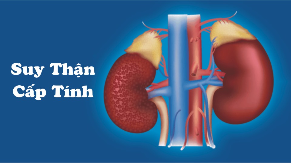 Những dấu hiệu của suy thận và cách điều trị bệnh