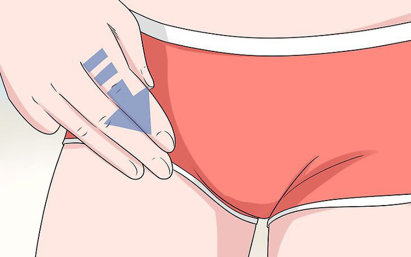 Nổi hạch ở bẹn là bệnh gì? Có phương pháp nào để điều trị không?