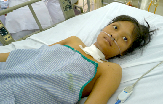 Sốt thương hàn có lây lan không?