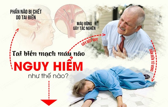 Tai biến mạch máu não dễ chết hơn bệnh ung thư