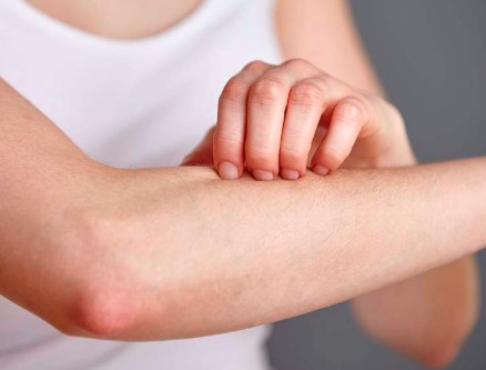 Cetirizin hydrochlorid – thuốc chống dị ứng không gây buồn ngủ