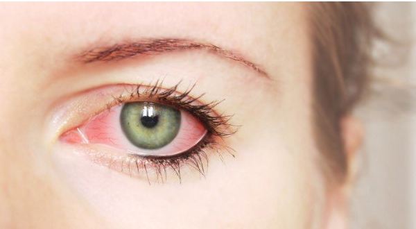 Tìm hiểu phương pháp điều trị xuất huyết võng mạc để chữa trị kịp thời tránh nguy hiểm đến thị lực