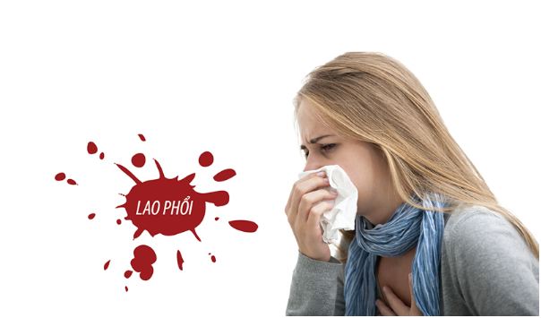 Triệu chứng của lao phổi là gì? Bệnh có nguy hiểm không?