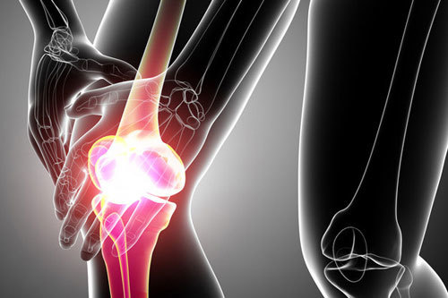 Triệu chứng ung thư xương giai đoạn cuối và các phương pháp chẩn đoán, điều trị bệnh