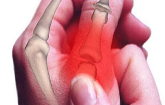 Ung thư xương: triệu chứng và liệu pháp điều trị