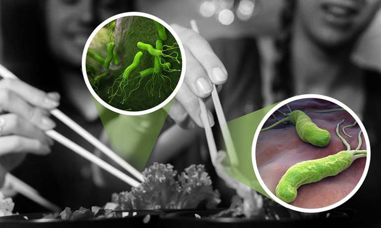 Vi khuẩn HP dạ dày có lây không? Nguyên nhân, triệu chứng và cách điều trị bệnh ra sao