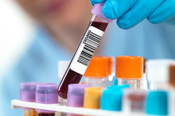 Vì sao nhiễm trùng huyết lại cực kỳ nguy hiểm? Những dấu hiệu nhận biết