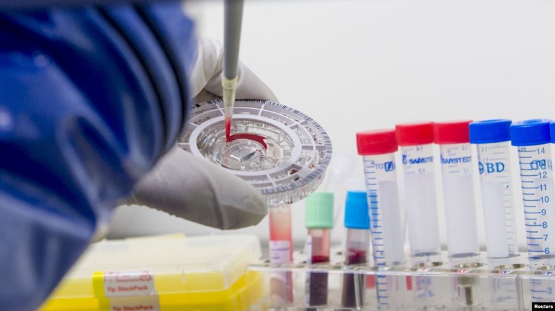 Ý nghĩa các chỉ số trong xét nghiệm Cholesterol là gì?