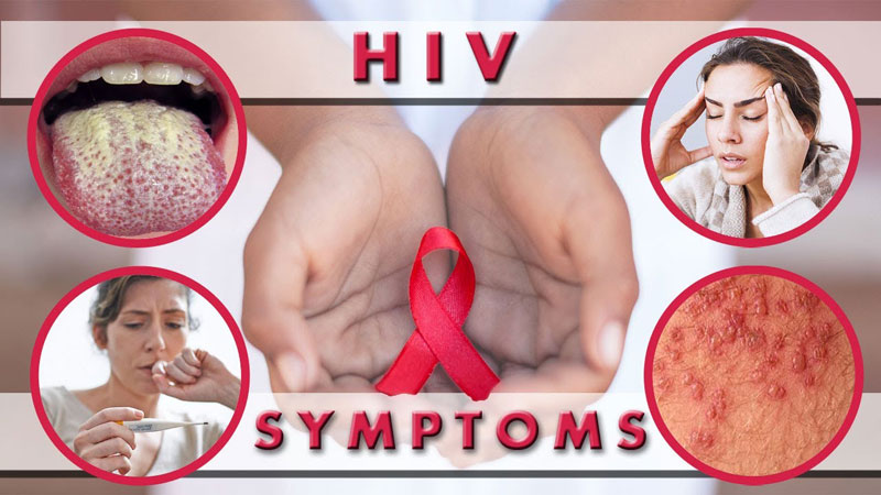 Dấu hiệu HIV là gì?