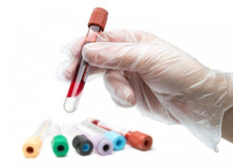Chỉ số bạch cầu mono trong xét nghiệm máu