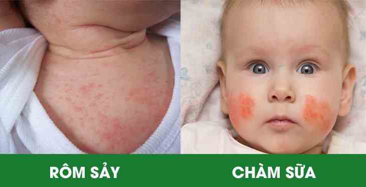 cham-sua-o-tre-so-sinh-kha-de-nhan-biet